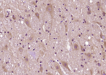 RTN1 Rabbit Polyclonal Antibody