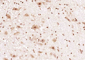 RGS14 Rabbit Polyclonal Antibody