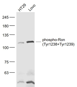 Phospho-Ron (Tyr1238+Tyr1239) Rabbit Polyclonal Antibody