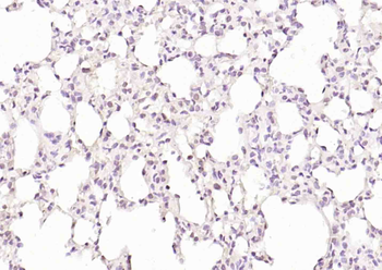 Phospho-RUNX1 (Ser249) Rabbit Polyclonal Antibody