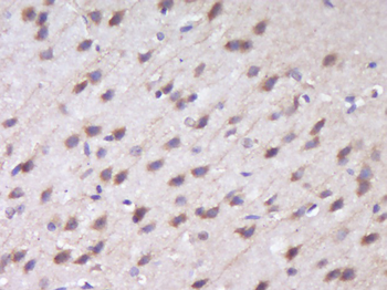 RUSC1 Rabbit Polyclonal Antibody