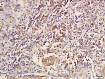 Sclerostin Rabbit Polyclonal Antibody