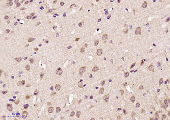 SHANK2 Rabbit Polyclonal Antibody