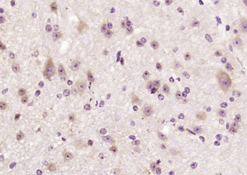 SHANK2 Rabbit Polyclonal Antibody