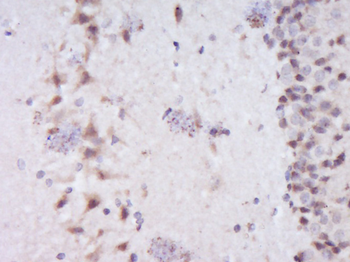 Dishevelled 2 Rabbit Polyclonal Antibody