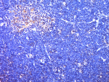 SKAP55 Rabbit Polyclonal Antibody