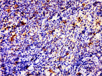 SLAP2 Rabbit Polyclonal Antibody