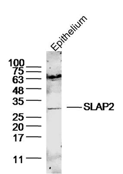 SLAP2 Rabbit Polyclonal Antibody