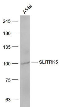 SLITRK5 Rabbit Polyclonal Antibody