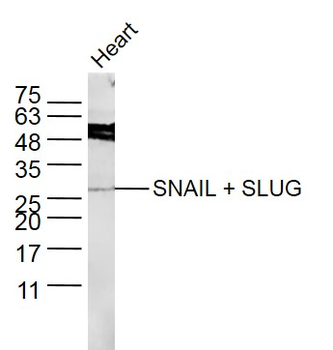 SNAIL + SLUG Rabbit Polyclonal Antibody