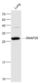 SNAP29 Rabbit Polyclonal Antibody