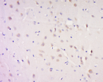 AP180 Rabbit Polyclonal Antibody