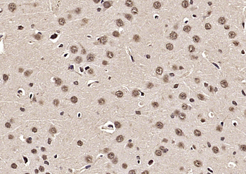 SOX1 Rabbit Polyclonal Antibody