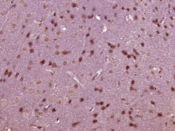 SOX8 Rabbit Polyclonal Antibody