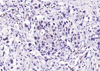 Phospho-SP1 (Thr453) Rabbit Polyclonal Antibody