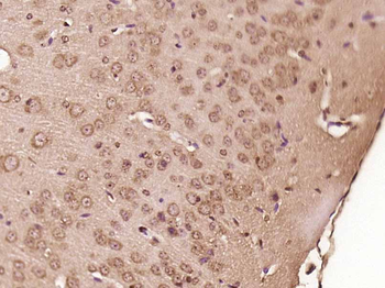 SPAG16 Rabbit Polyclonal Antibody