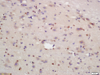 SPAG17 Rabbit Polyclonal Antibody