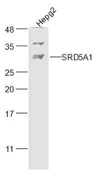 SRD5A1 Rabbit Polyclonal Antibody
