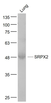 SRPX2 Rabbit Polyclonal Antibody