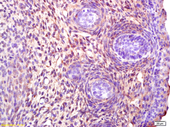 Stella Rabbit Polyclonal Antibody
