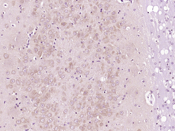 STOML2 Rabbit Polyclonal Antibody