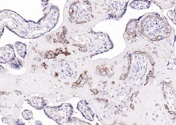STRA6 Rabbit Polyclonal Antibody