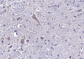 SV2B Rabbit Polyclonal Antibody