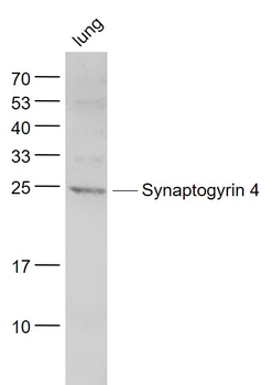 Synaptogyrin 4 Rabbit Polyclonal Antibody
