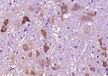 Syntaxin 13 Rabbit Polyclonal Antibody
