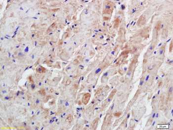 Syntrophin-2 Rabbit Polyclonal Antibody
