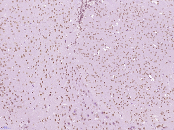 TBP Rabbit Polyclonal Antibody