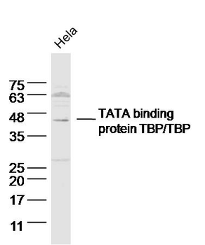 TBP Rabbit Polyclonal Antibody
