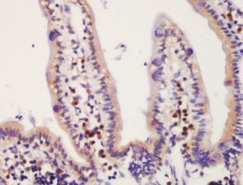 HIC5 Rabbit Polyclonal Antibody