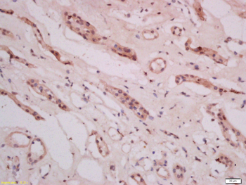 THEMIS Rabbit Polyclonal Antibody