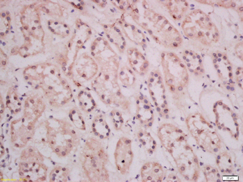THEMIS Rabbit Polyclonal Antibody