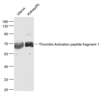 Thrombin Activation peptide fragment 1 Rabbit Polyclonal Antibody