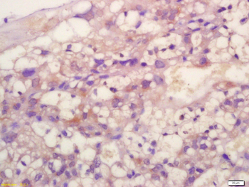 TIMP-2 Rabbit Polyclonal Antibody