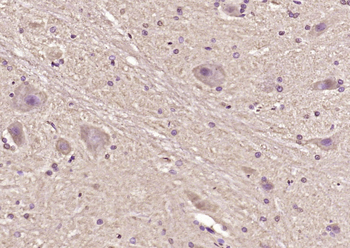 Tinagl1 Rabbit Polyclonal Antibody