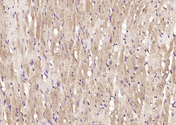 TJP2 Rabbit Polyclonal Antibody