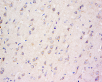 TJP2 Rabbit Polyclonal Antibody