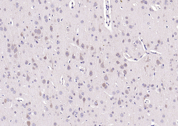 TMP21 Rabbit Polyclonal Antibody