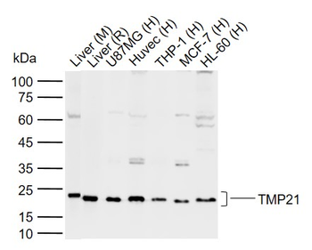 TMP21 Rabbit Polyclonal Antibody