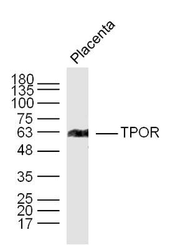 TPOR Rabbit Polyclonal Antibody