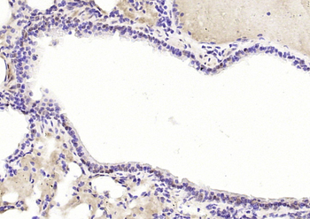 TRAF6BP Rabbit Polyclonal Antibody