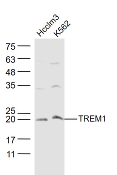 TREM1 Rabbit Polyclonal Antibody