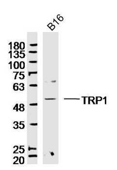 TYRP1 Rabbit Polyclonal Antibody