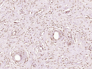 TRRAP Rabbit Polyclonal Antibody