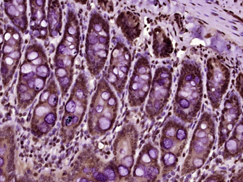 ASPSCR1 Rabbit Polyclonal Antibody