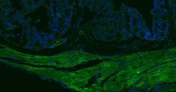 Alpha smooth muscle Actin Mouse Monoclonal Antibody (BF488)
