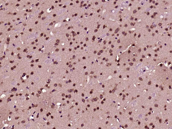 UBR5 Rabbit Polyclonal Antibody